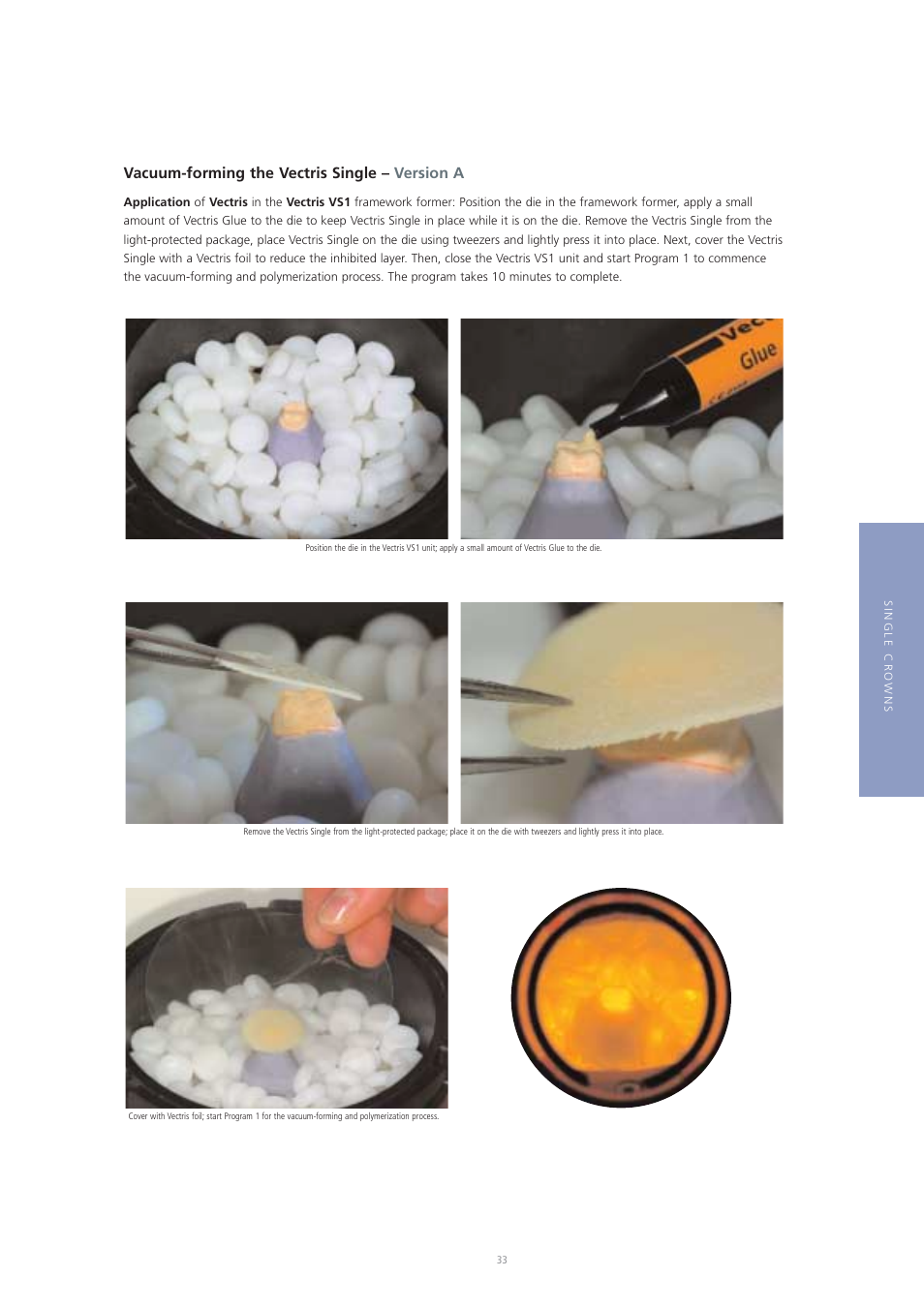 Vacuum-forming the vectris single – version a | Ivoclar Vivadent Vectris User Manual | Page 33 / 60