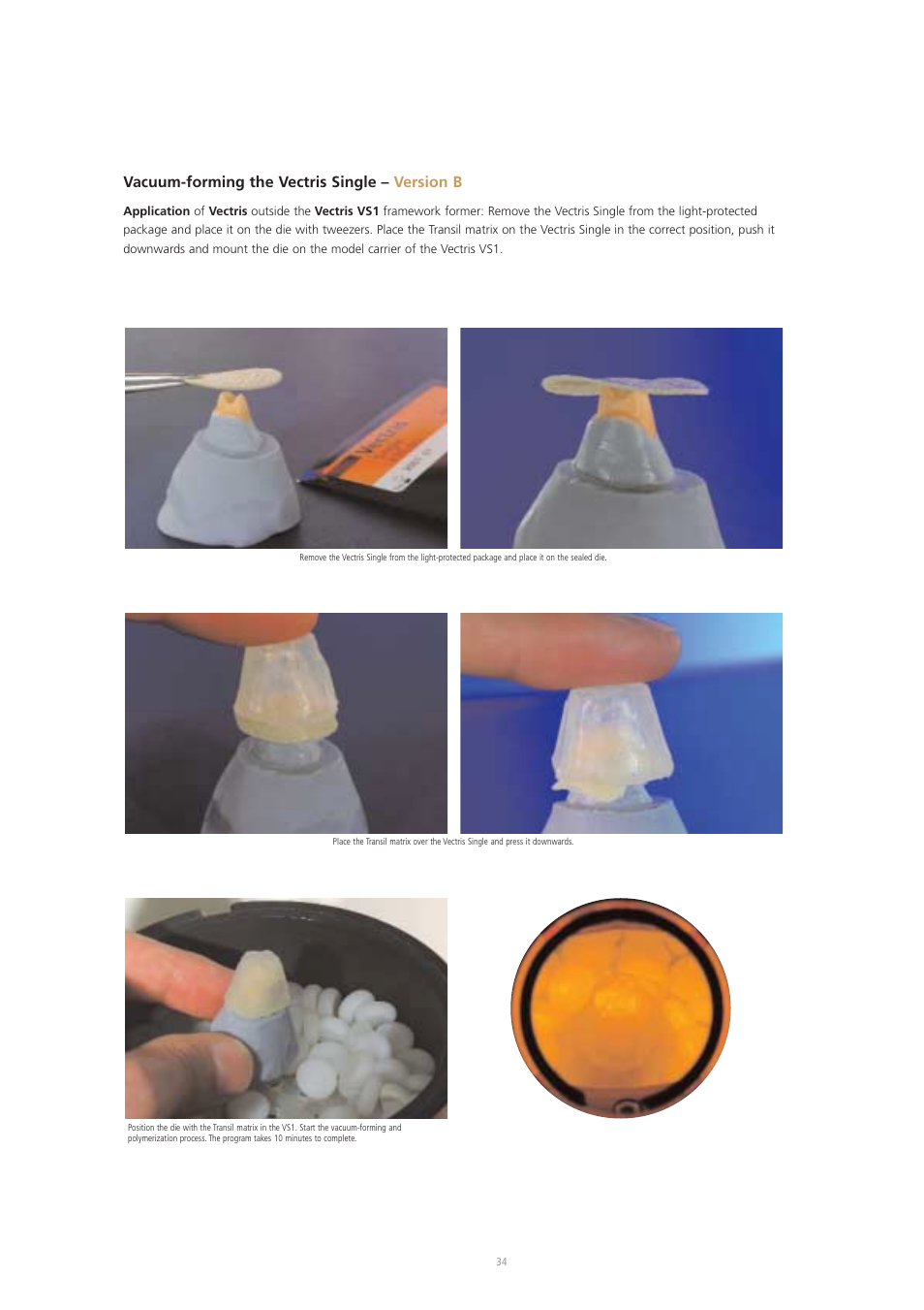 Vacuum-forming the vectris single – version b | Ivoclar Vivadent Vectris User Manual | Page 34 / 60