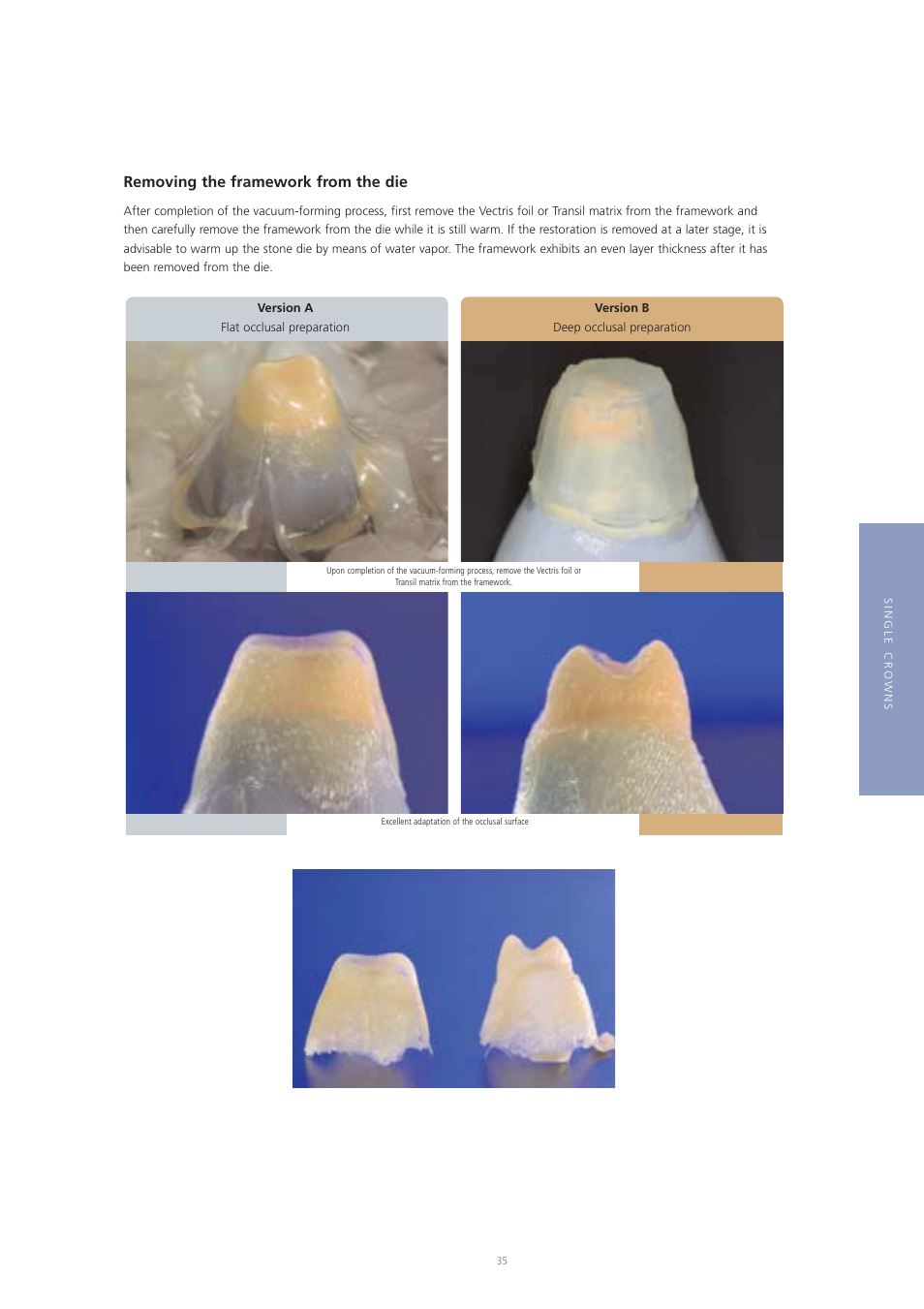 Removing the framework from the die | Ivoclar Vivadent Vectris User Manual | Page 35 / 60