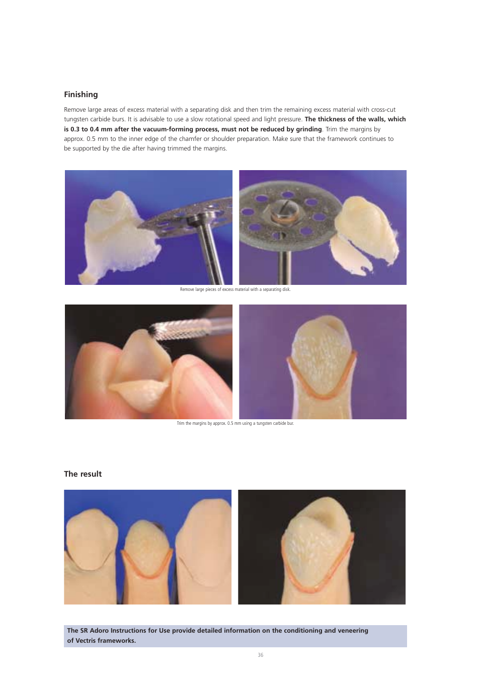 Finishing, The result | Ivoclar Vivadent Vectris User Manual | Page 36 / 60