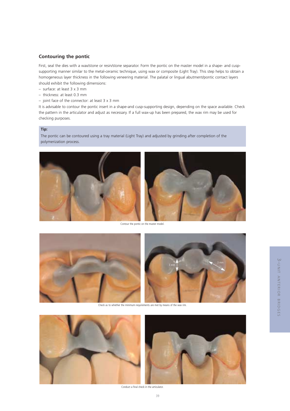 Contouring the pontic | Ivoclar Vivadent Vectris User Manual | Page 39 / 60