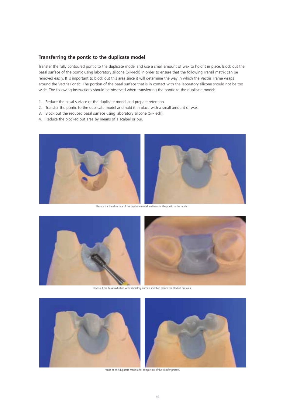 Transferring the pontic to the duplicate model | Ivoclar Vivadent Vectris User Manual | Page 40 / 60