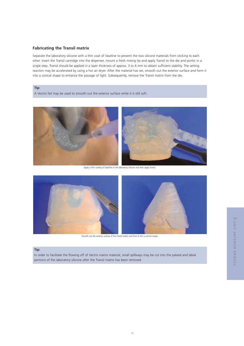 Fabricating the transil matrix | Ivoclar Vivadent Vectris User Manual | Page 41 / 60