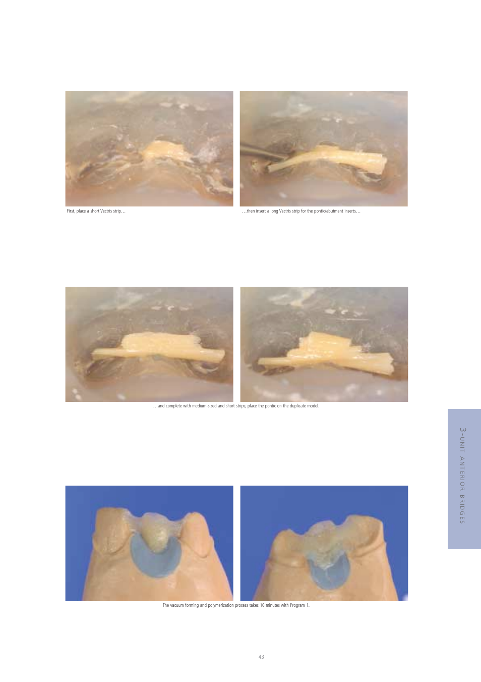 Ivoclar Vivadent Vectris User Manual | Page 43 / 60