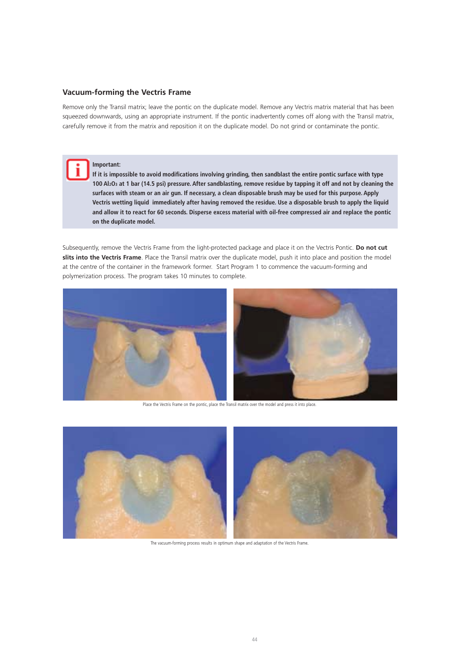 Vacuum-forming the vectris frame | Ivoclar Vivadent Vectris User Manual | Page 44 / 60