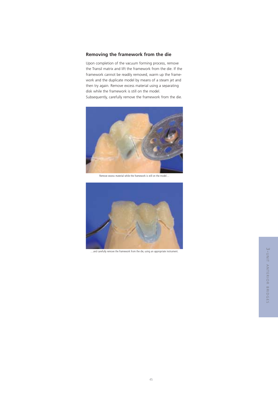 Removing the framework from the die | Ivoclar Vivadent Vectris User Manual | Page 45 / 60