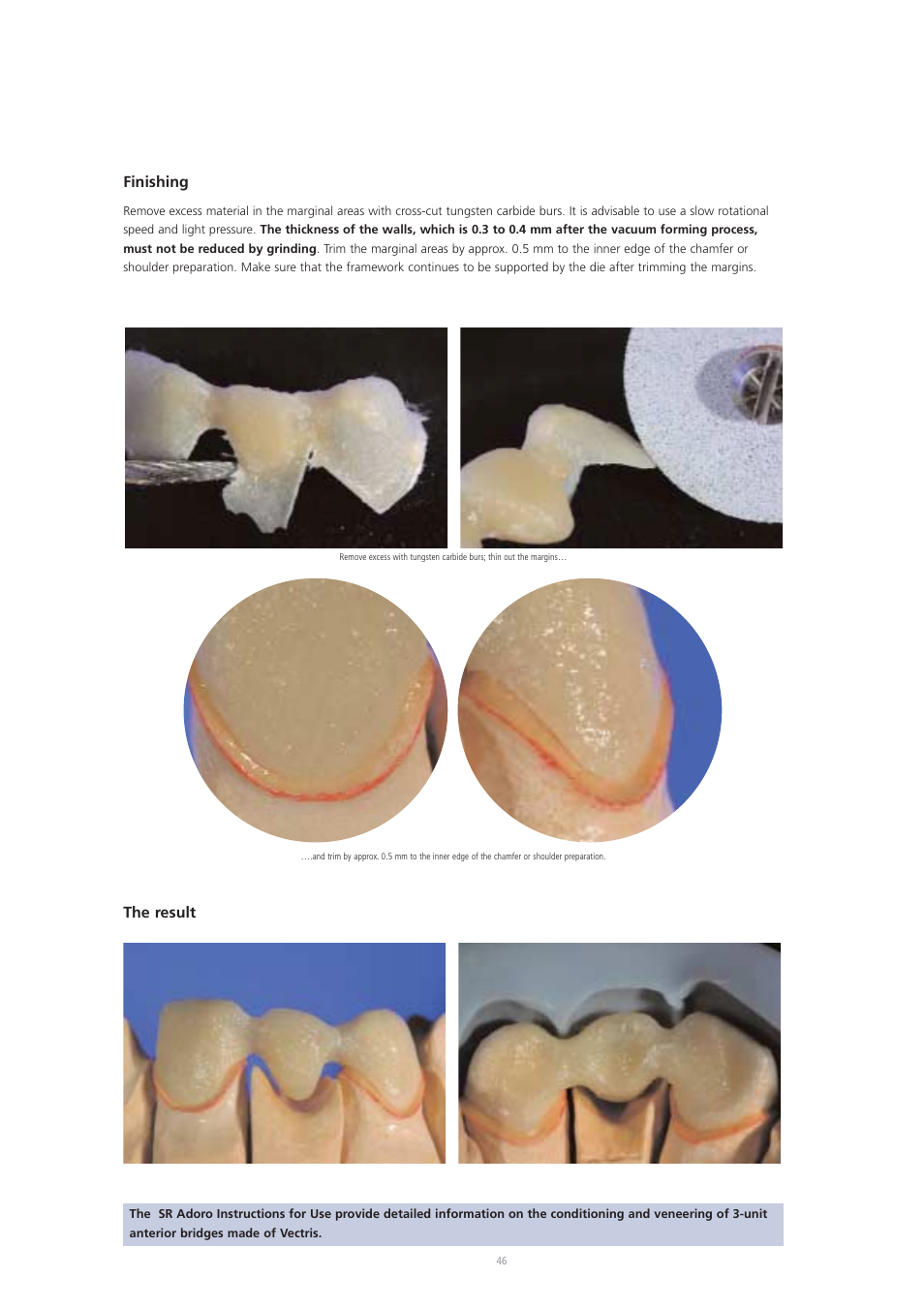 Finishing, The result | Ivoclar Vivadent Vectris User Manual | Page 46 / 60