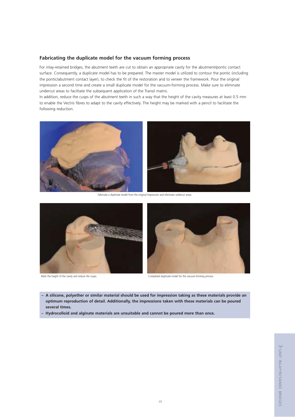 Ivoclar Vivadent Vectris User Manual | Page 49 / 60