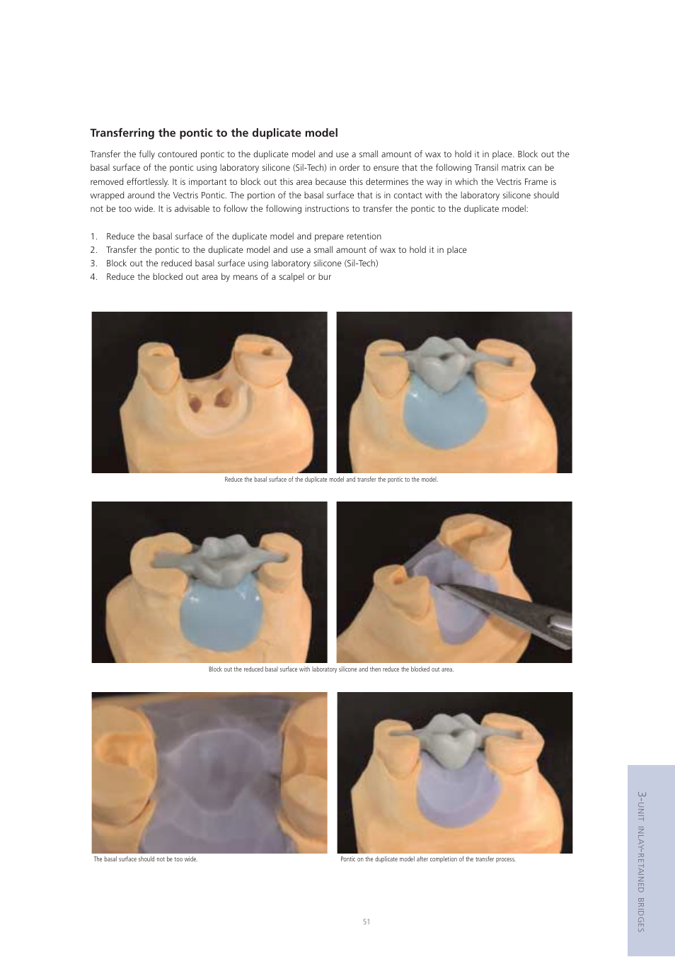 Transferring the pontic to the duplicate model | Ivoclar Vivadent Vectris User Manual | Page 51 / 60