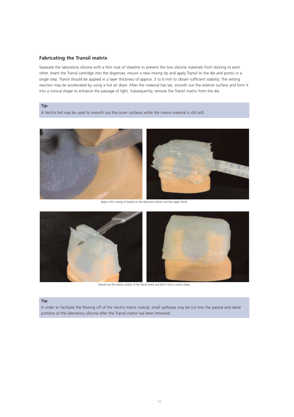 Fabricating the transil matrix | Ivoclar Vivadent Vectris User Manual | Page 52 / 60