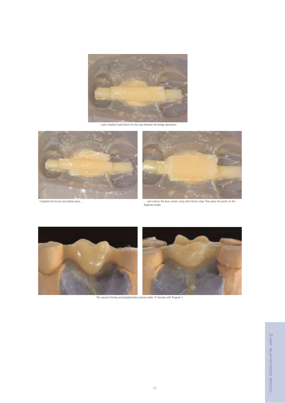 Ivoclar Vivadent Vectris User Manual | Page 55 / 60