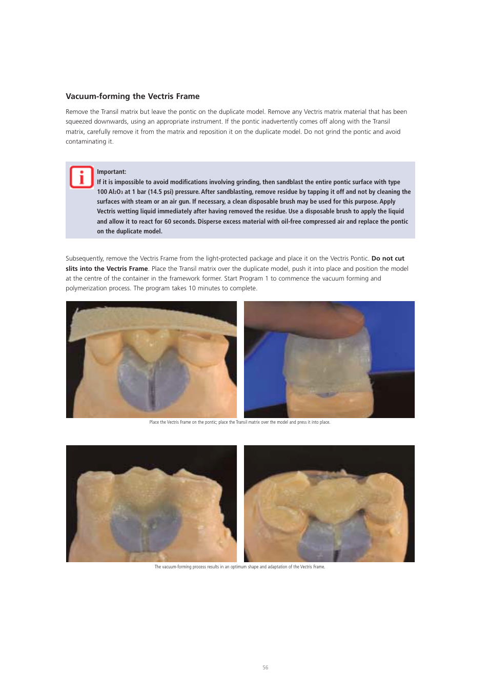 Vacuum-forming the vectris frame | Ivoclar Vivadent Vectris User Manual | Page 56 / 60