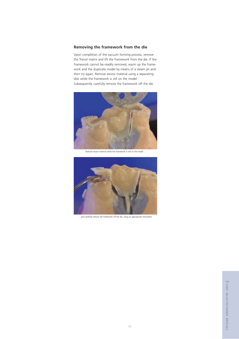 Removing the framework from the die | Ivoclar Vivadent Vectris User Manual | Page 57 / 60