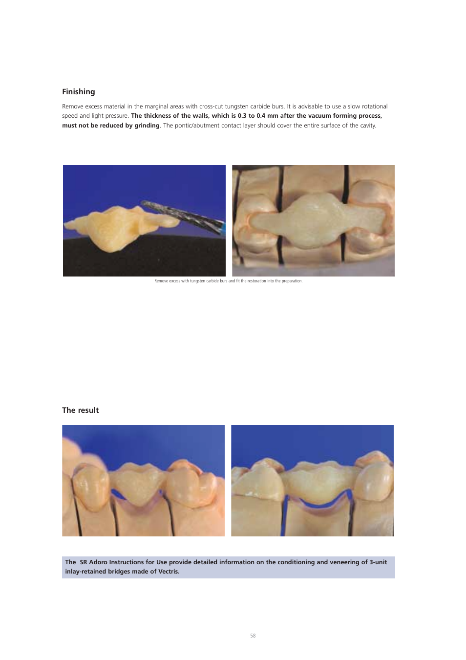 Finishing, The result | Ivoclar Vivadent Vectris User Manual | Page 58 / 60