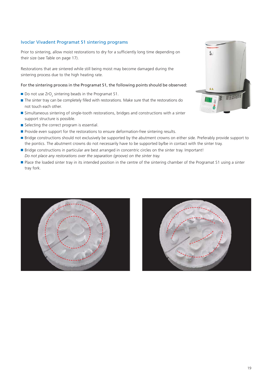 Ivoclar Vivadent Zenostar User Manual | Page 19 / 60