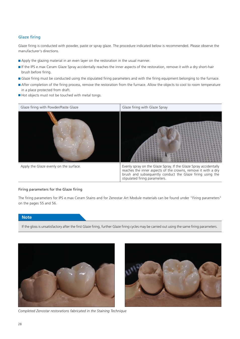 Ivoclar Vivadent Zenostar User Manual | Page 28 / 60