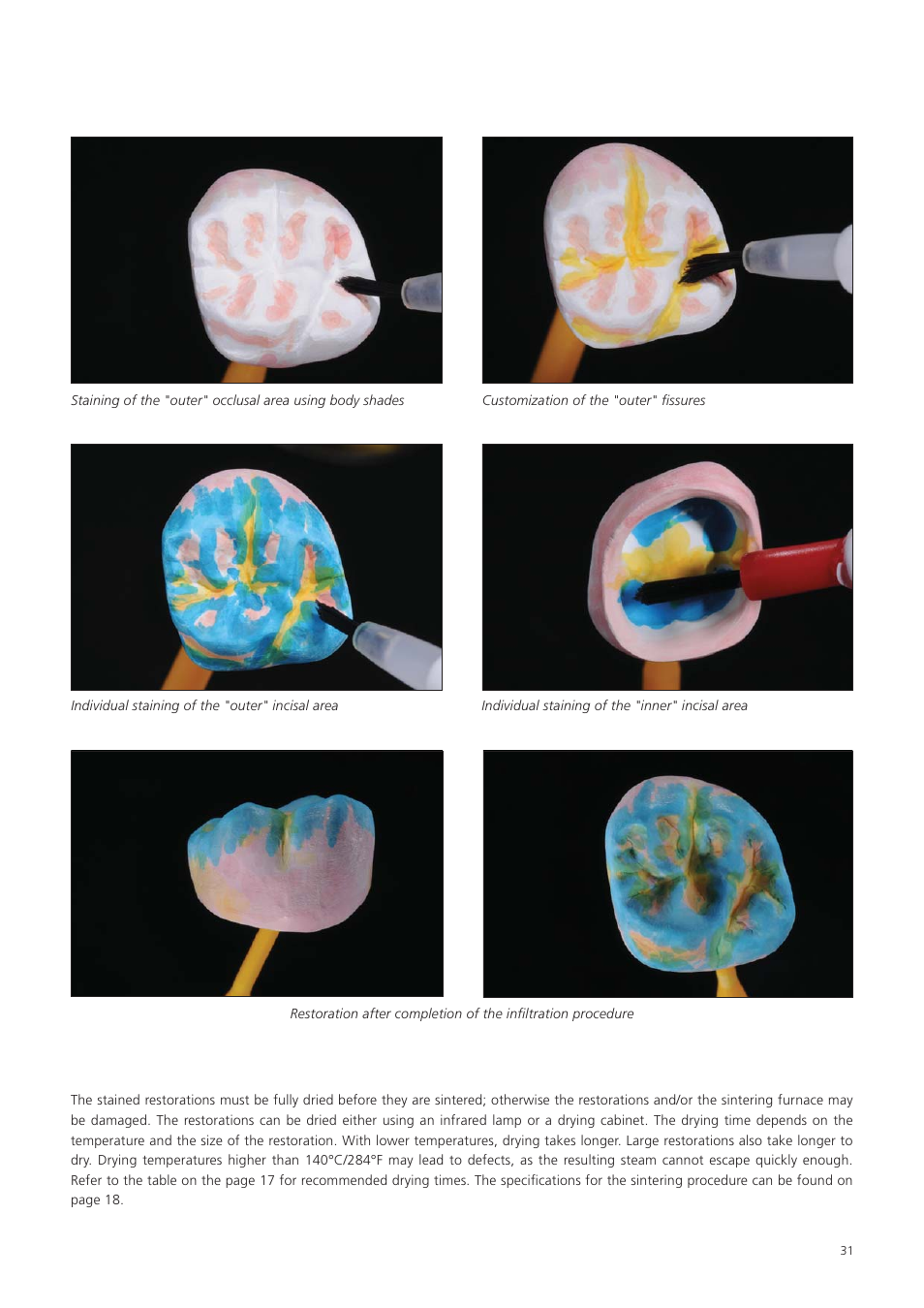 Ivoclar Vivadent Zenostar User Manual | Page 31 / 60