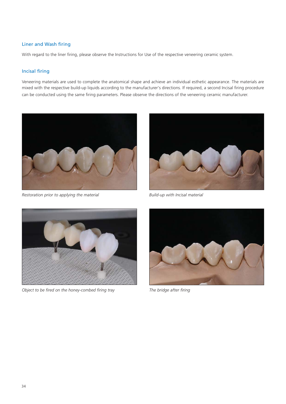 Ivoclar Vivadent Zenostar User Manual | Page 34 / 60