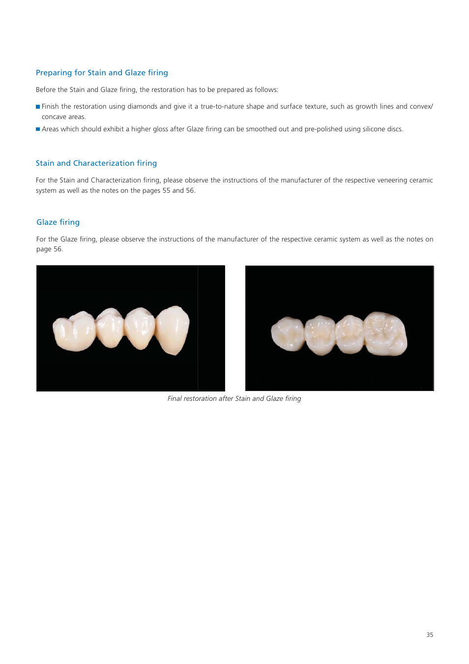 Ivoclar Vivadent Zenostar User Manual | Page 35 / 60