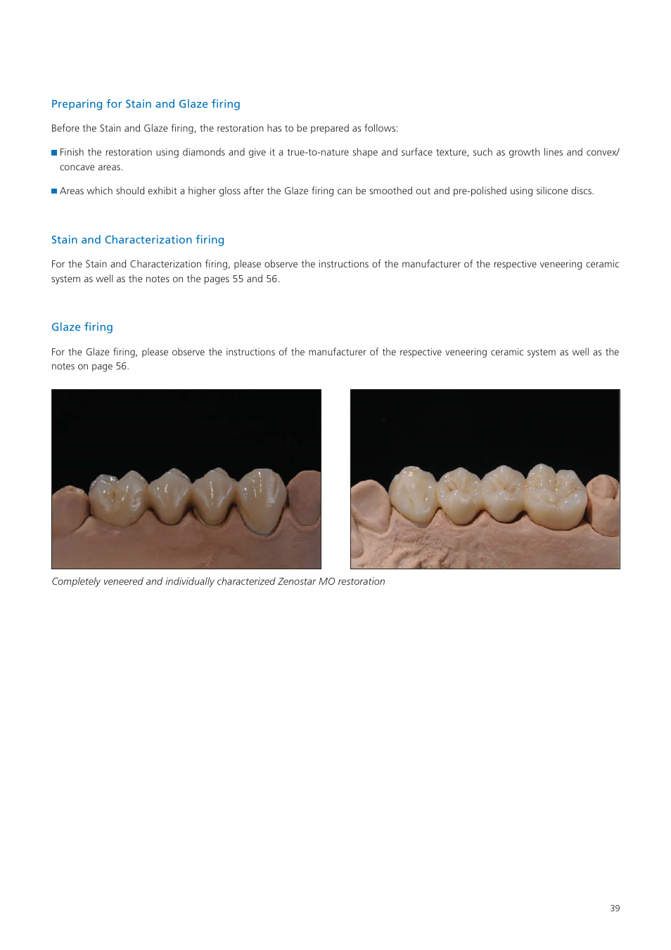 Ivoclar Vivadent Zenostar User Manual | Page 39 / 60