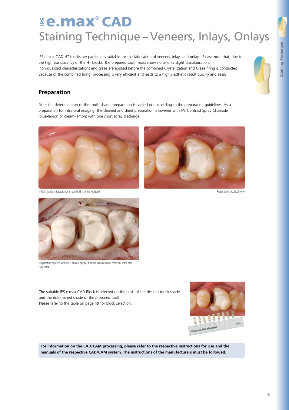 E.max, Processing options, Staining technique – veneers, inlays, onlays | Ivoclar Vivadent IPS e.max CAD Chairside User Manual | Page 19 / 52