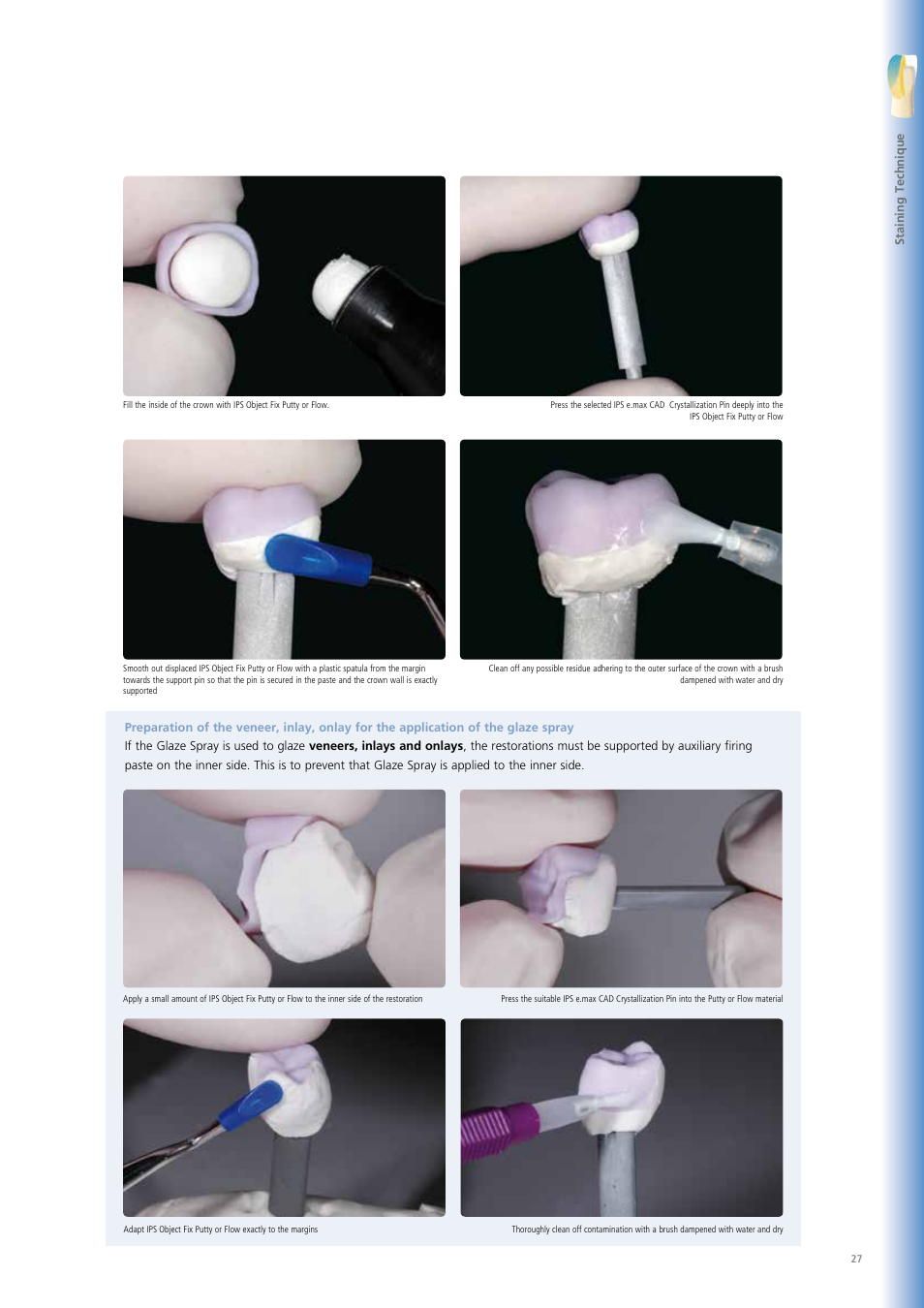Ivoclar Vivadent IPS e.max CAD Chairside User Manual | Page 27 / 52