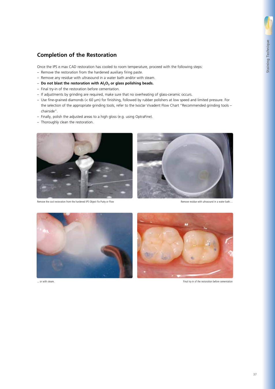 Completion of the restoration | Ivoclar Vivadent IPS e.max CAD Chairside User Manual | Page 37 / 52