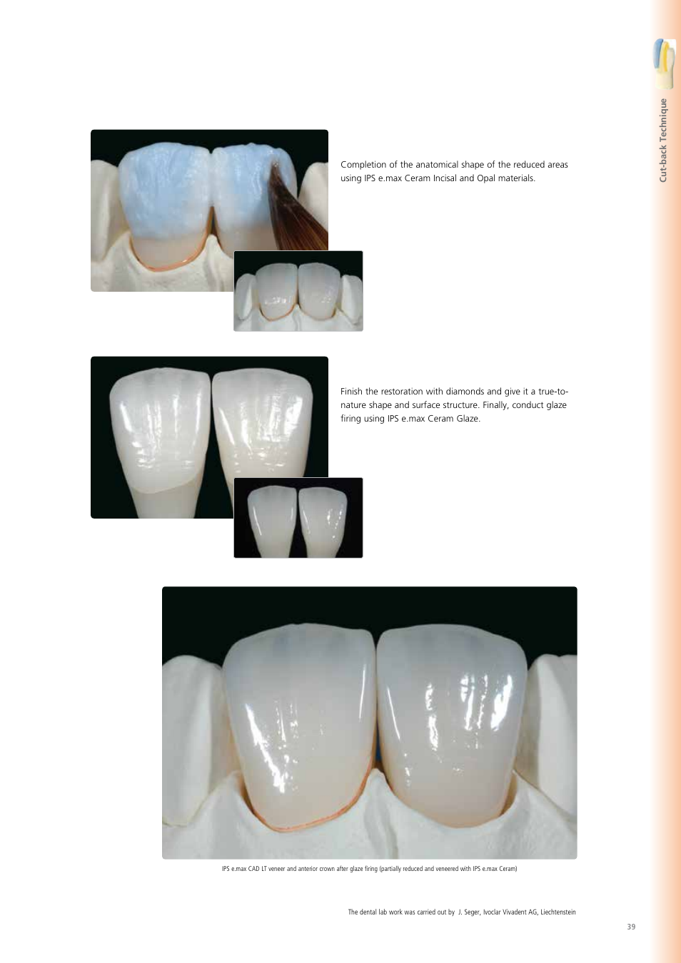 Ivoclar Vivadent IPS e.max CAD Chairside User Manual | Page 39 / 52