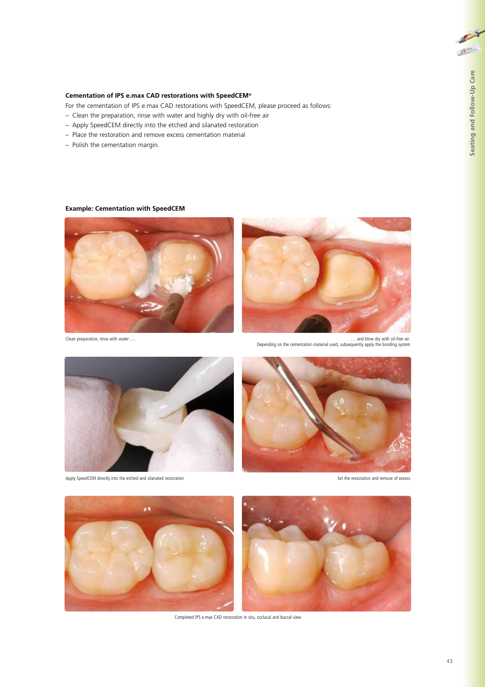 Ivoclar Vivadent IPS e.max CAD Chairside User Manual | Page 43 / 52