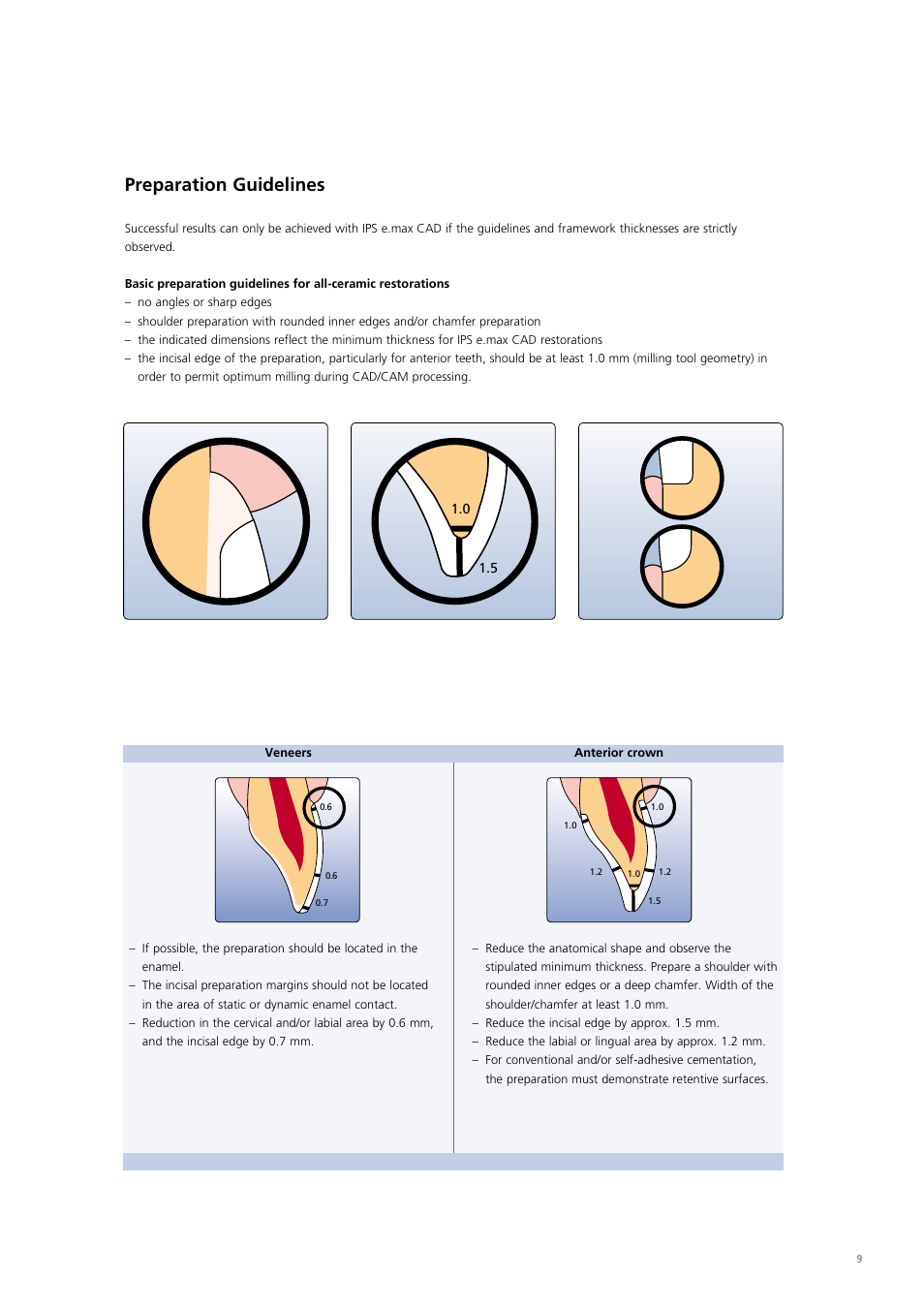 Preparation guidelines | Ivoclar Vivadent IPS e.max CAD Chairside User Manual | Page 9 / 52