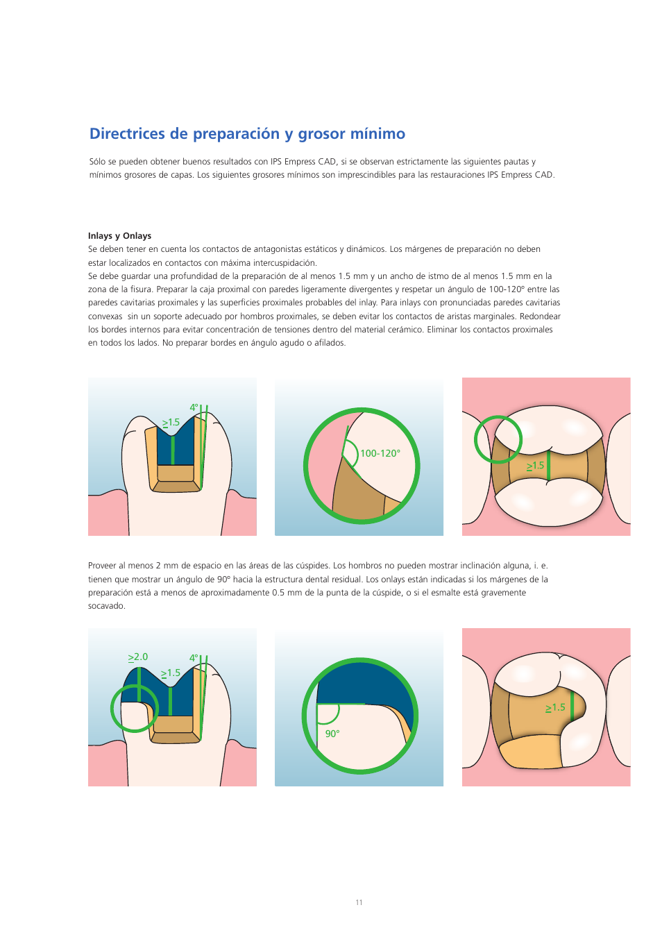 Directrices de preparación y grosor mínimo | Ivoclar Vivadent IPS Empress CAD Chairside - de-en-es-it-ru User Manual | Page 107 / 240