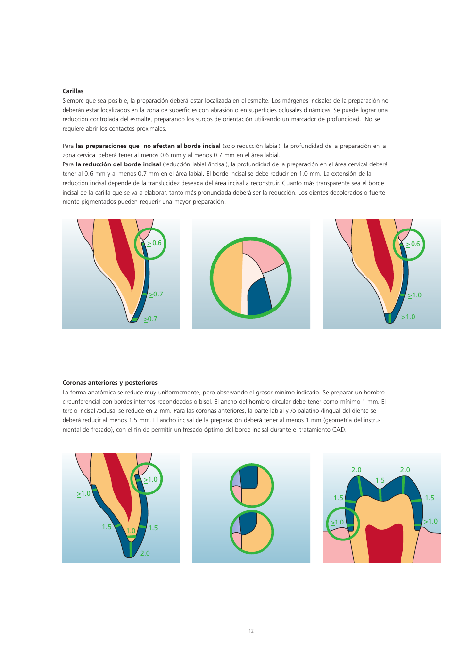 Ivoclar Vivadent IPS Empress CAD Chairside - de-en-es-it-ru User Manual | Page 108 / 240