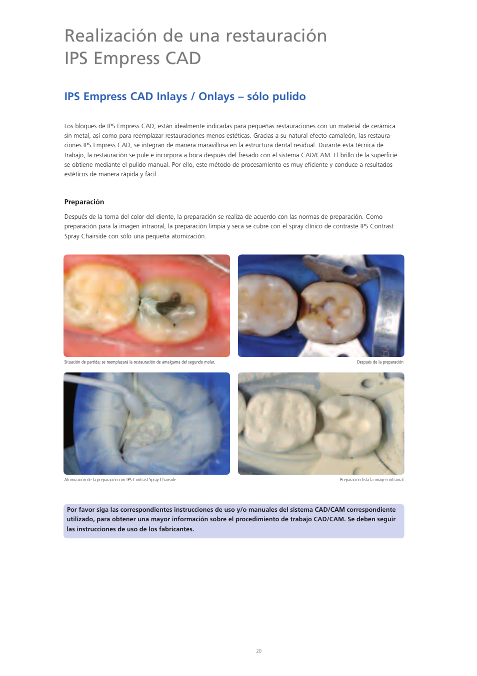 Realización de una restauración ips empress cad, Ips empress cad inlays / onlays – sólo pulido | Ivoclar Vivadent IPS Empress CAD Chairside - de-en-es-it-ru User Manual | Page 116 / 240