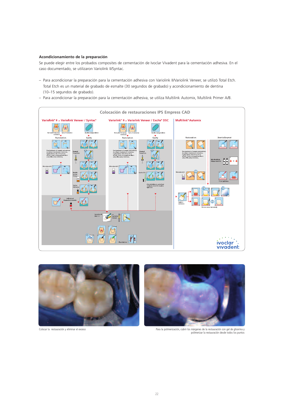 Ivoclar Vivadent IPS Empress CAD Chairside - de-en-es-it-ru User Manual | Page 118 / 240