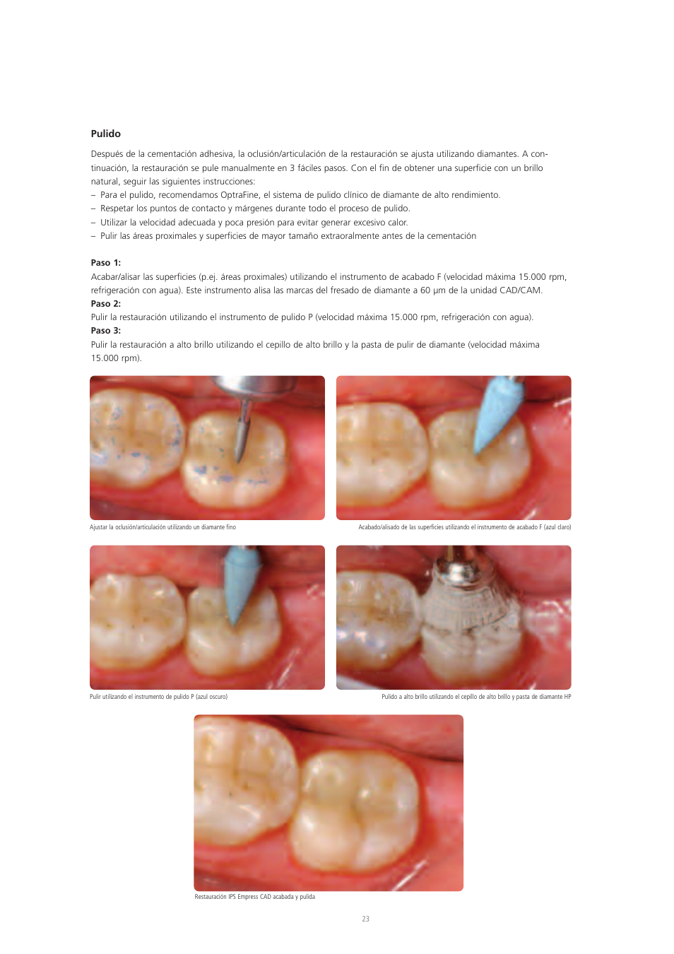 Ivoclar Vivadent IPS Empress CAD Chairside - de-en-es-it-ru User Manual | Page 119 / 240