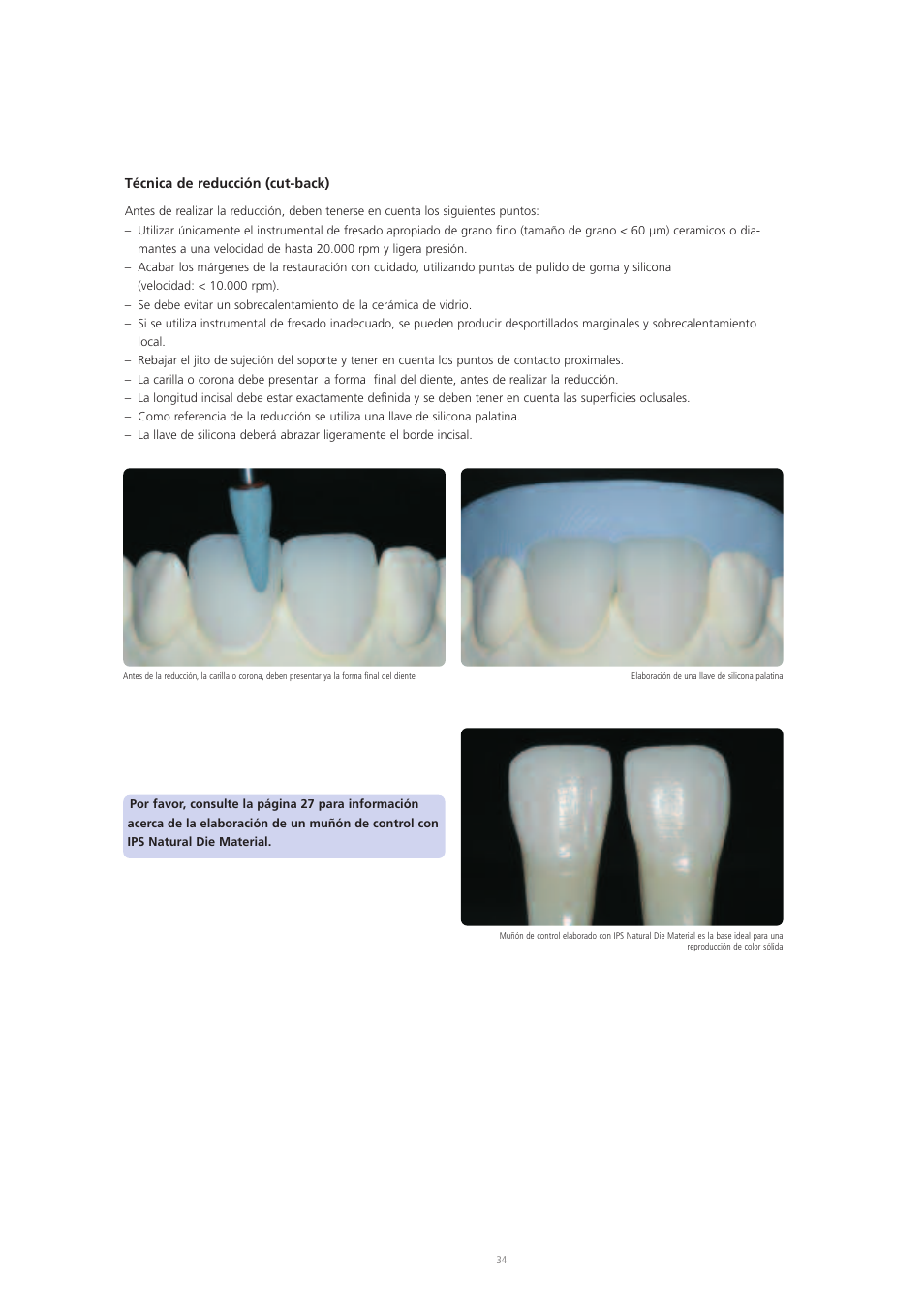Ivoclar Vivadent IPS Empress CAD Chairside - de-en-es-it-ru User Manual | Page 130 / 240