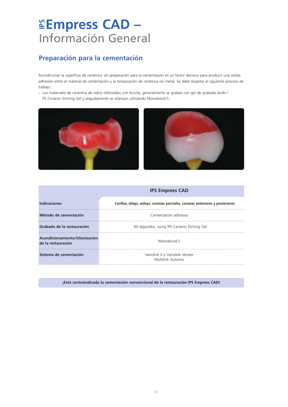 Empress cad, Información general, Ip s | Preparación para la cementación | Ivoclar Vivadent IPS Empress CAD Chairside - de-en-es-it-ru User Manual | Page 137 / 240