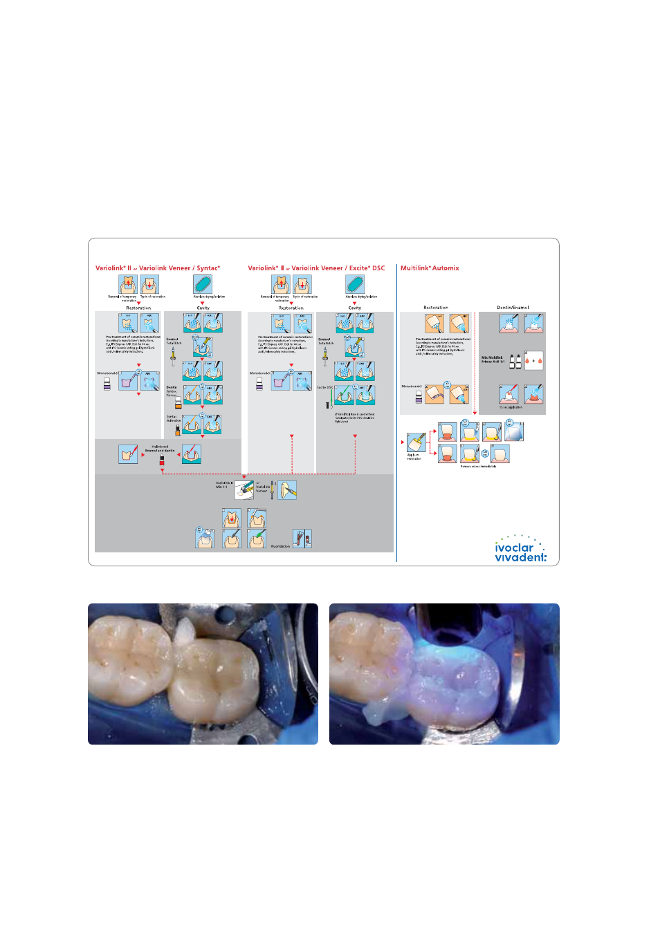 Ivoclar Vivadent IPS Empress CAD Chairside - de-en-es-it-ru User Manual | Page 166 / 240
