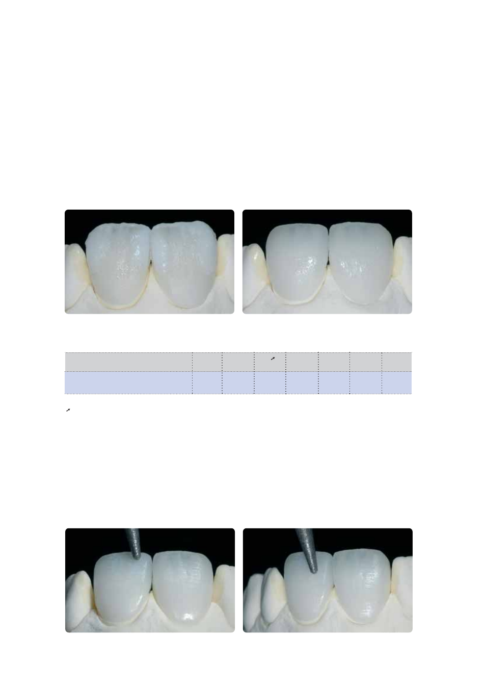 Ivoclar Vivadent IPS Empress CAD Chairside - de-en-es-it-ru User Manual | Page 182 / 240