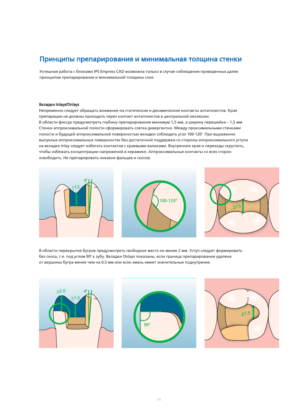 Ivoclar Vivadent IPS Empress CAD Chairside - de-en-es-it-ru User Manual | Page 203 / 240