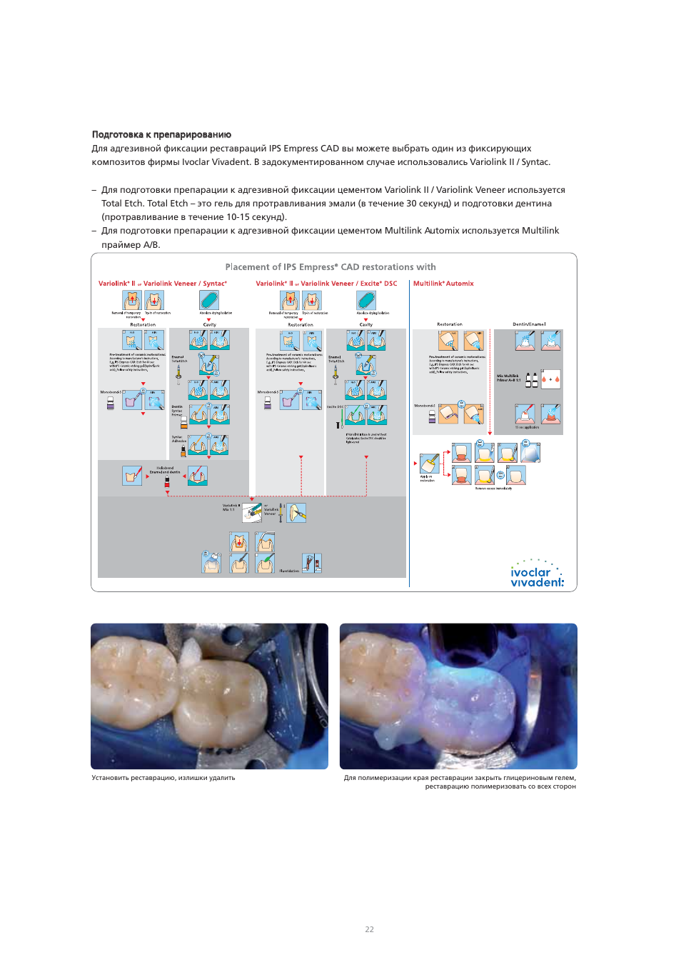 Ivoclar Vivadent IPS Empress CAD Chairside - de-en-es-it-ru User Manual | Page 214 / 240