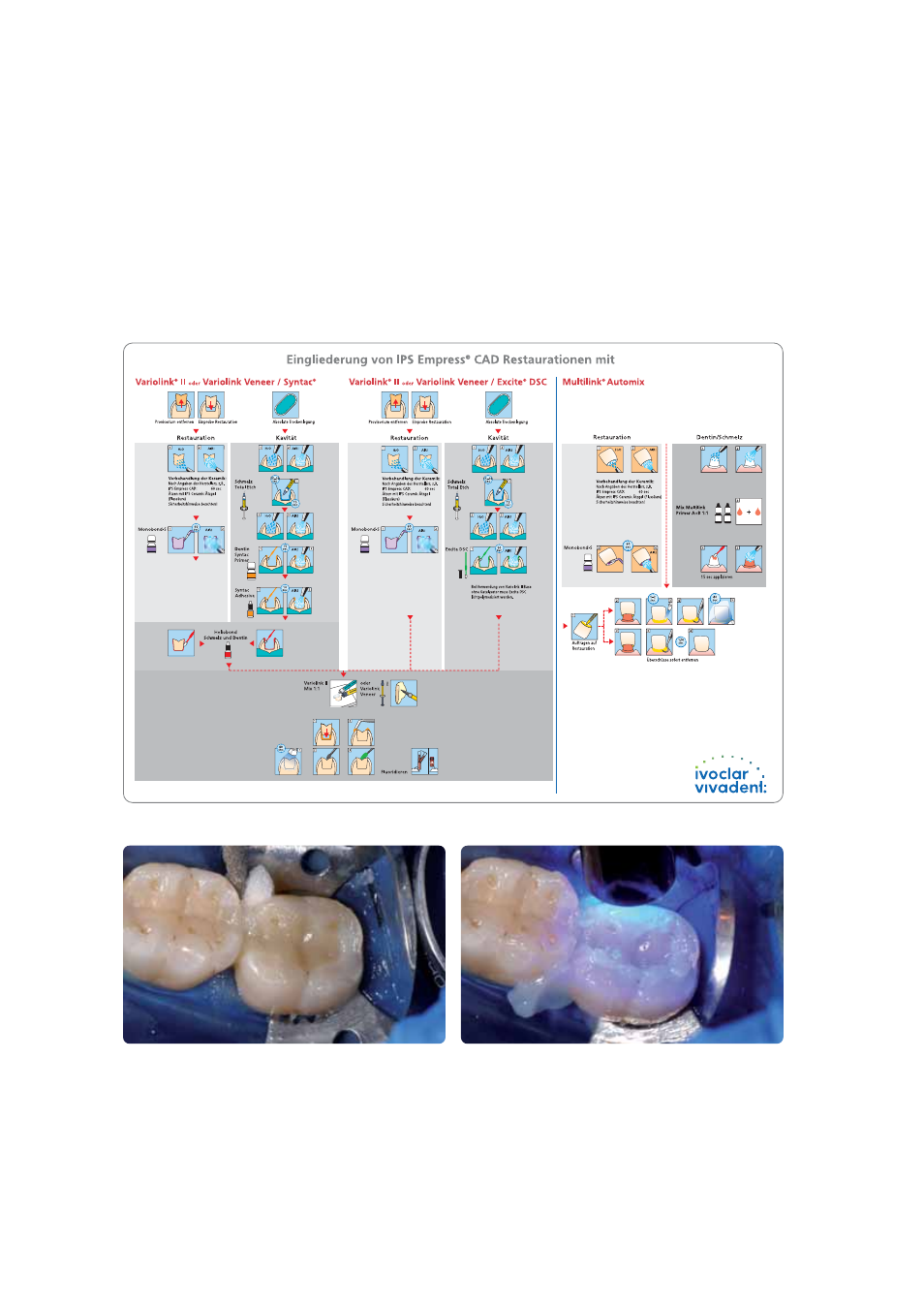 Ivoclar Vivadent IPS Empress CAD Chairside - de-en-es-it-ru User Manual | Page 22 / 240