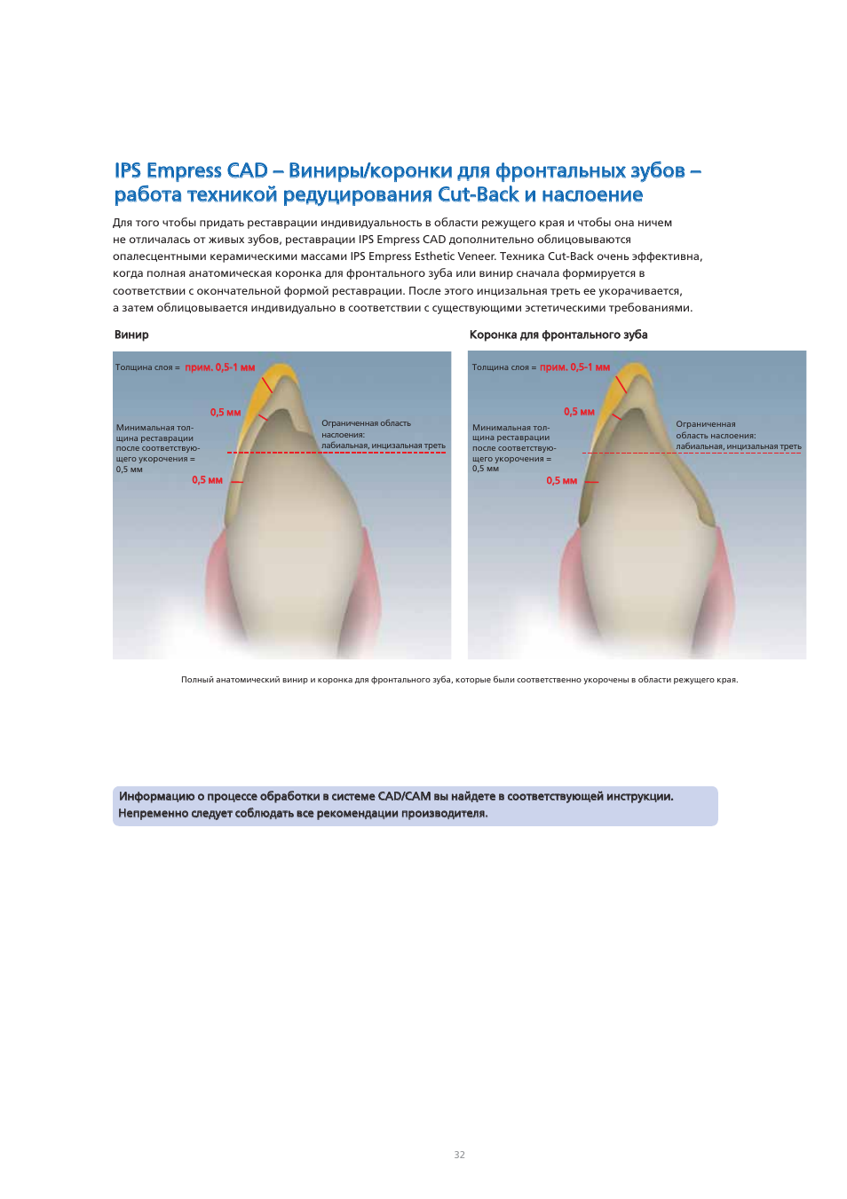 Ivoclar Vivadent IPS Empress CAD Chairside - de-en-es-it-ru User Manual | Page 224 / 240