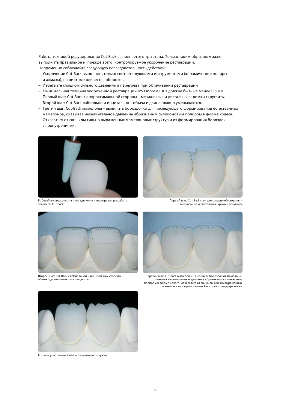 Ivoclar Vivadent IPS Empress CAD Chairside - de-en-es-it-ru User Manual | Page 227 / 240