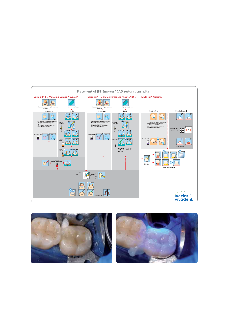 Ivoclar Vivadent IPS Empress CAD Chairside - de-en-es-it-ru User Manual | Page 70 / 240