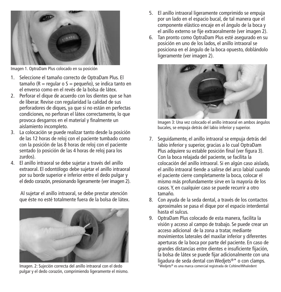 Ivoclar Vivadent OptraDam Plus User Manual | Page 10 / 31