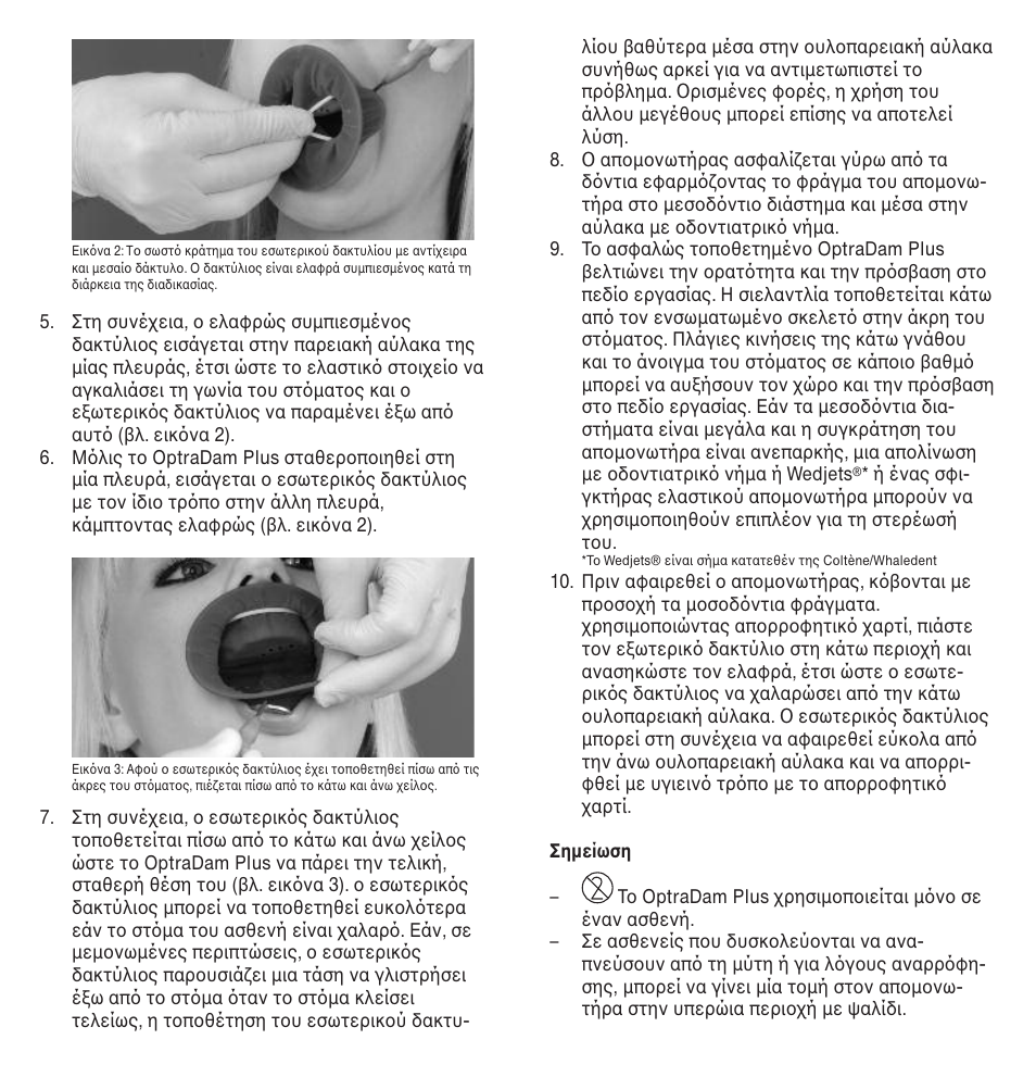 Ivoclar Vivadent OptraDam Plus User Manual | Page 25 / 31