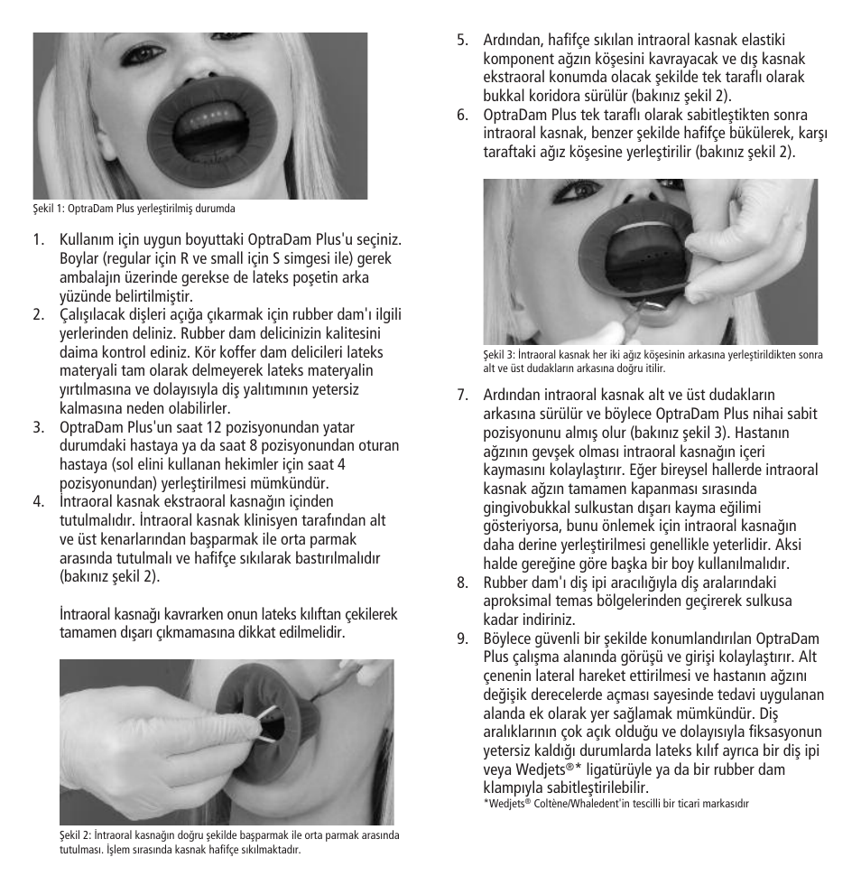 Ivoclar Vivadent OptraDam Plus User Manual | Page 27 / 31