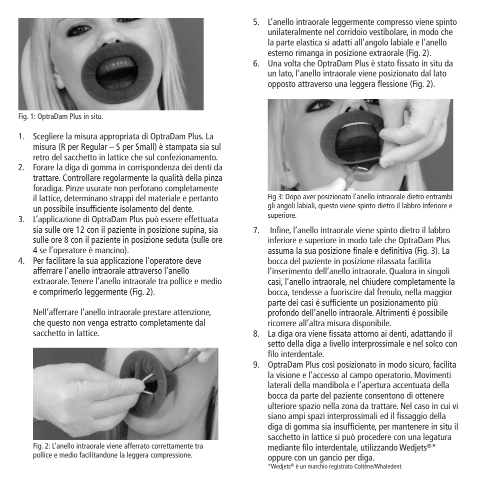 Ivoclar Vivadent OptraDam Plus User Manual | Page 8 / 31