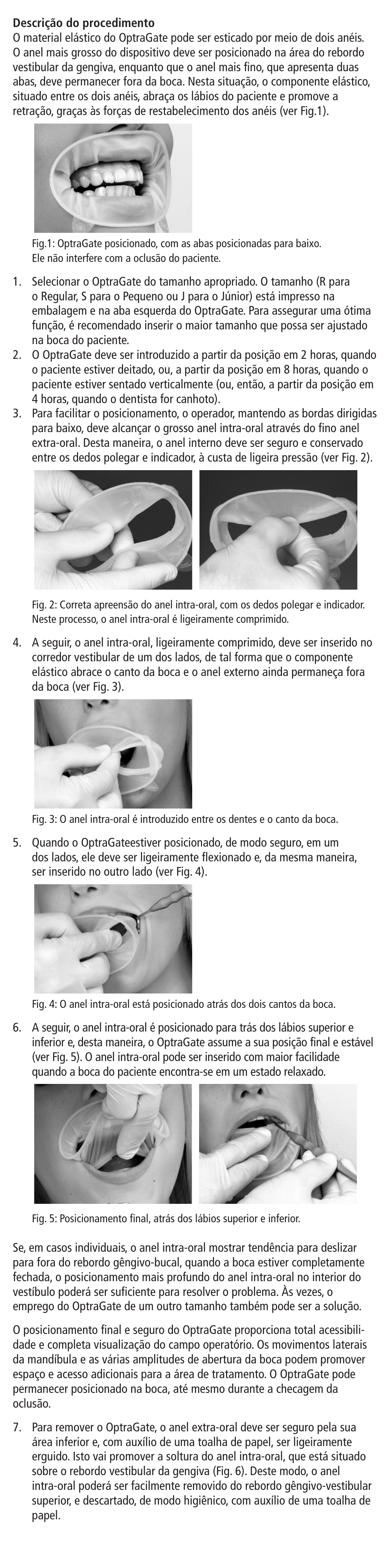 Ivoclar Vivadent OptraGate User Manual | Page 10 / 48